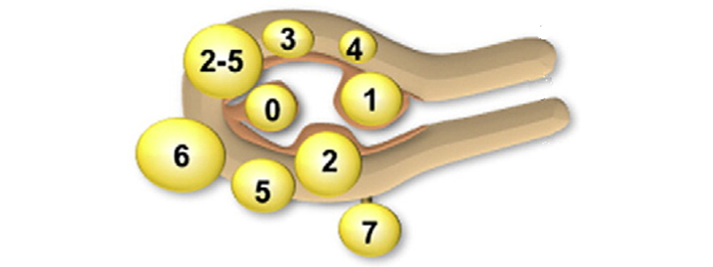 Classification FIGO des fibromes utérins