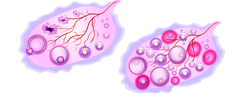 Ovulation