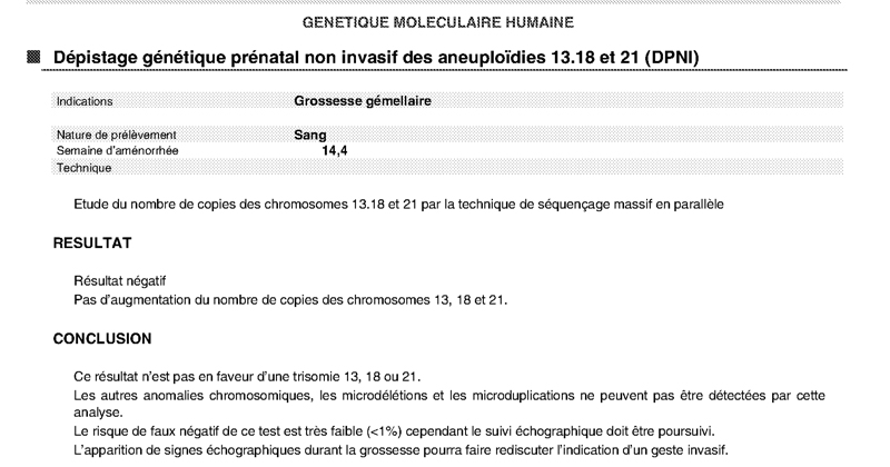 Resultat DPNI grossesse gemellaire