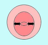 ectropion